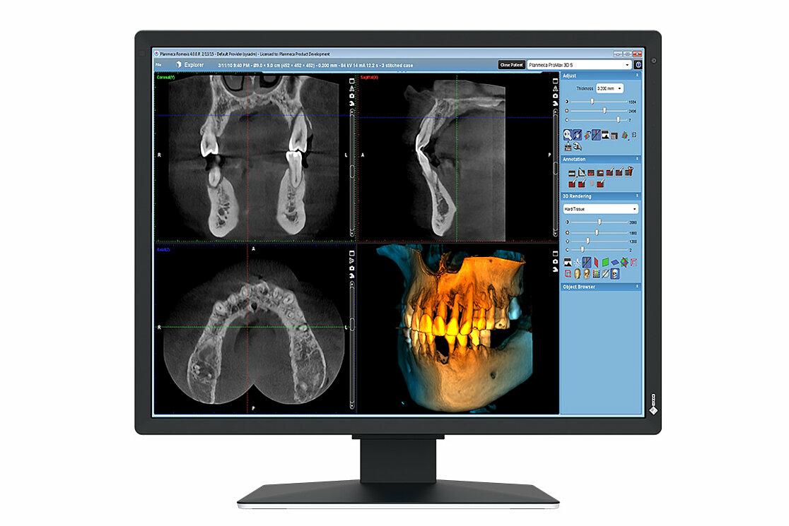 EIZO RadiForce MX217-SB...