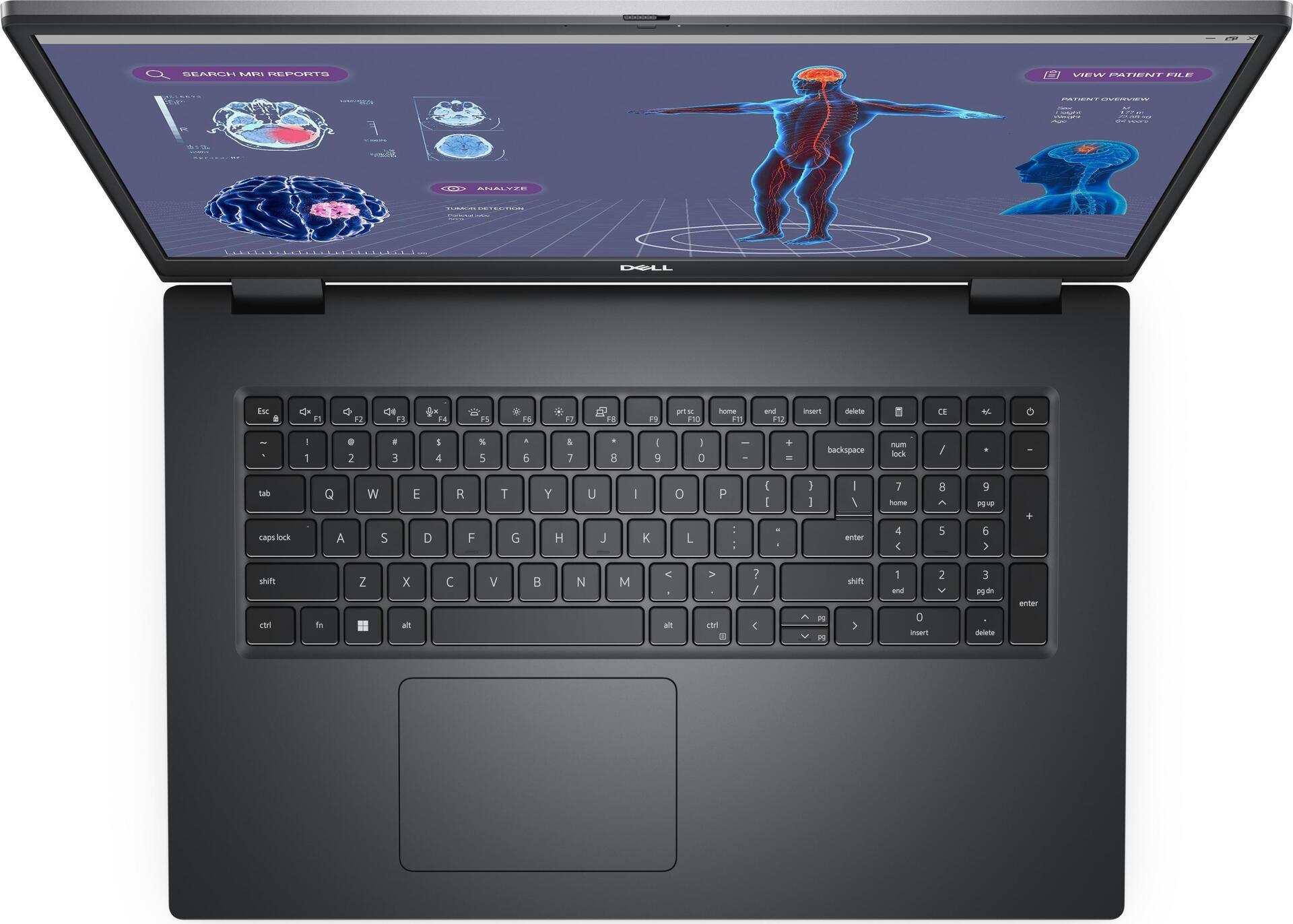 PRECISION 7780 I9-13950HX 32GB - 1TB SSD 17IN FHD W11P - Versione Tedesca
