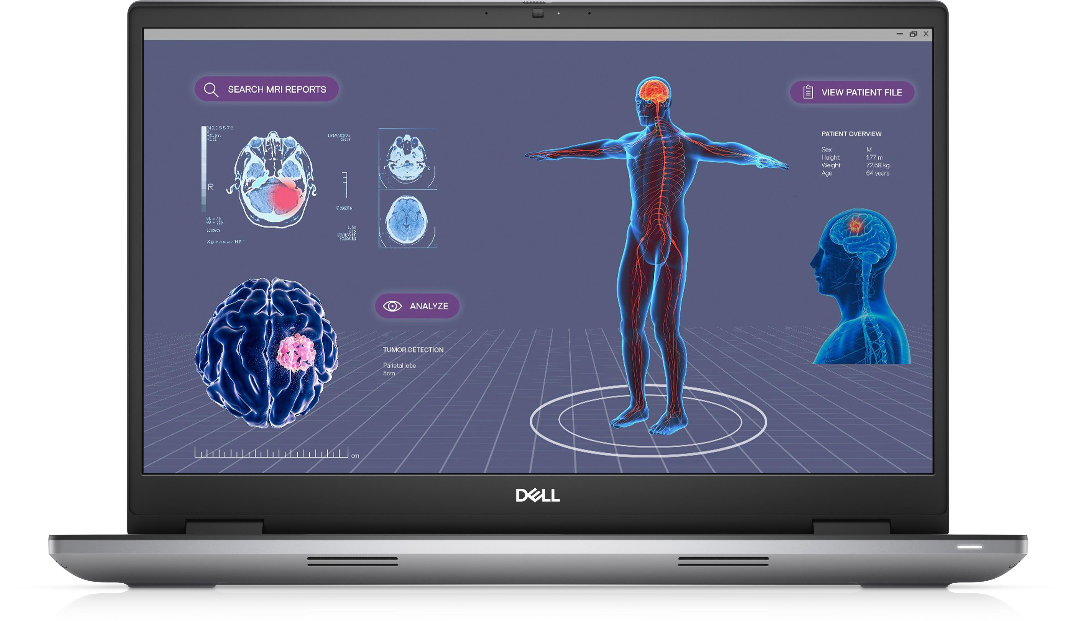 DELL Precision 7780 IntelÂ®...