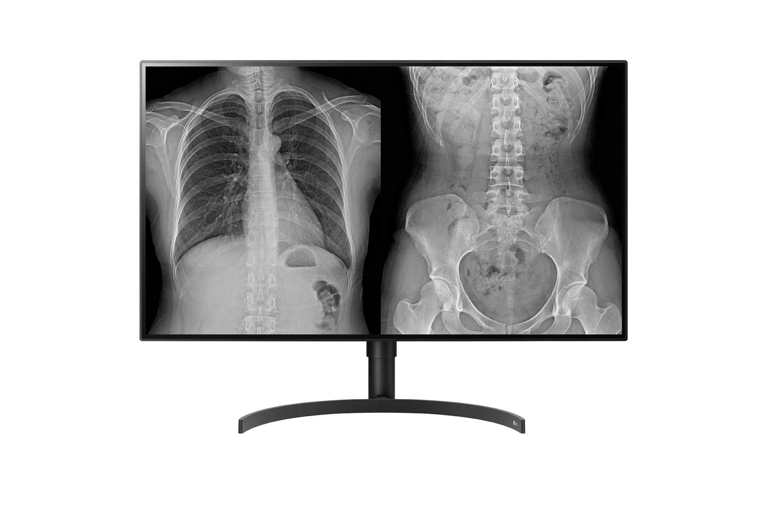 LG 32HL512D-B Monitor PC 80 cm (31.5") 3840 x 2160 Pixel Full HD Nero