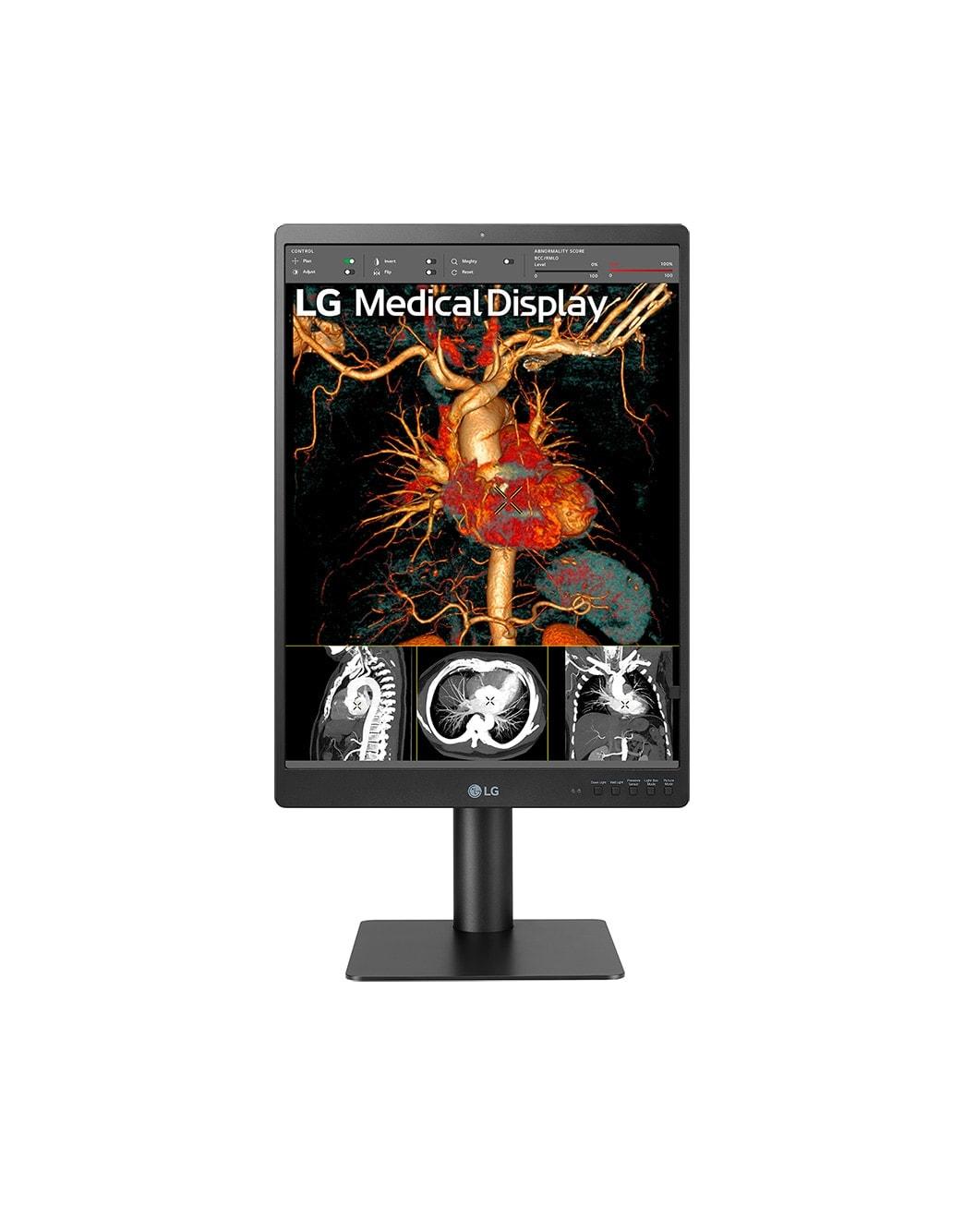LG 21HQ513D-B/21" Grayscale 3MP Monitor PC 541 cm 21.3 1536 x 2048 Pixel HD LCD Nero (LG 21 21HQ513D-B Diagnose TFT DP2.0D)